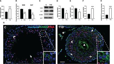 Type 1 diabetes impairs the activity of rat testicular somatic and germ cells through NRF2/NLRP3 pathway-mediated oxidative stress